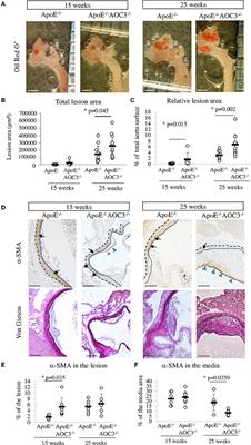 Increased atherosclerotic plaque in AOC3 knock-out in ApoE−/− mice and characterization of AOC3 in atherosclerotic human coronary arteries